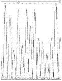 Detection method of gene related to alcohol metabolism