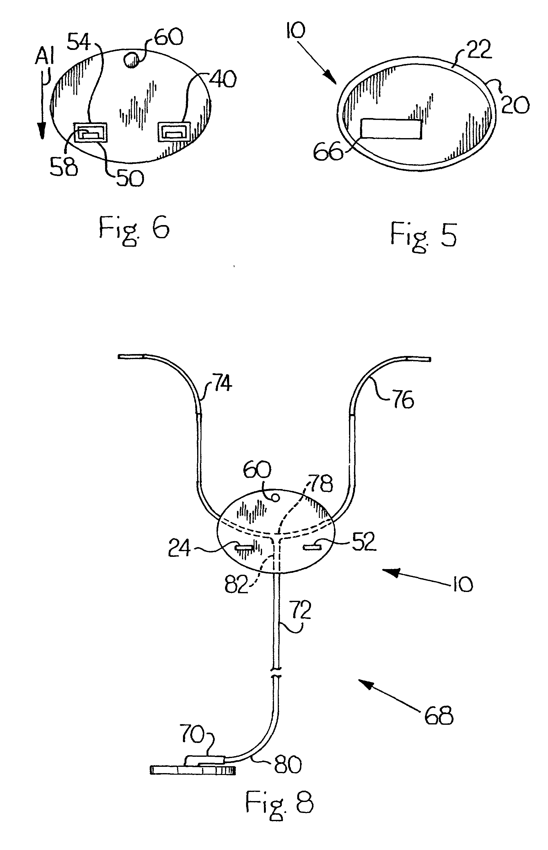 Adjustably locking stethoscope identification tag