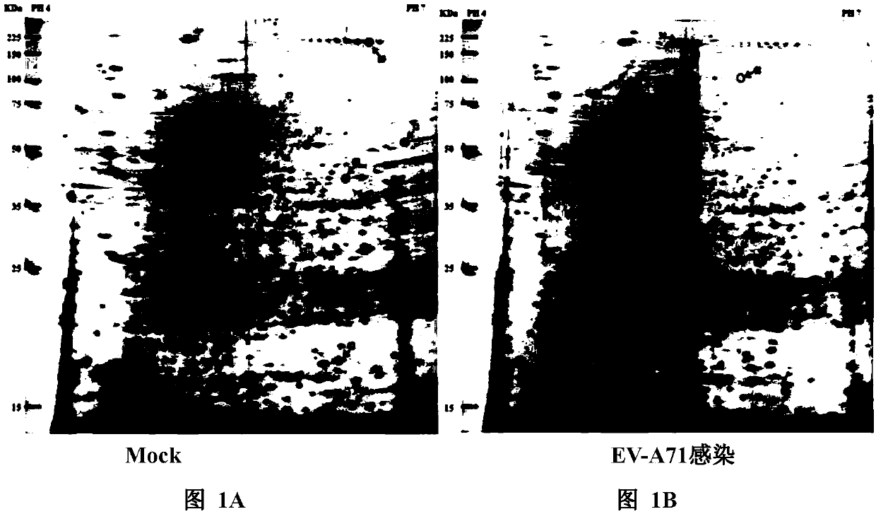 Method for targeting Hsp27 to inhibit enterovirus type A71 infection and related applications