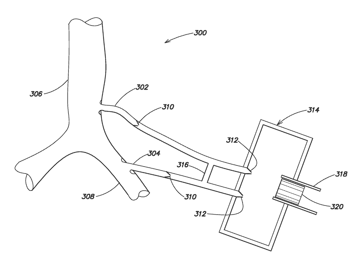 System for producing continuous mechanical energy to treat heart failure without the use of external energy source