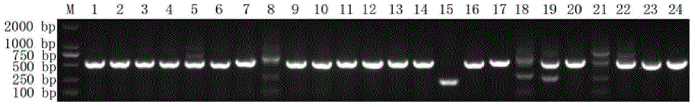 Bactrian camel-derived ApoE nano antibody as well as coding sequence and application thereof