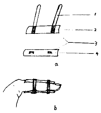 Splint for fixing finger fracture