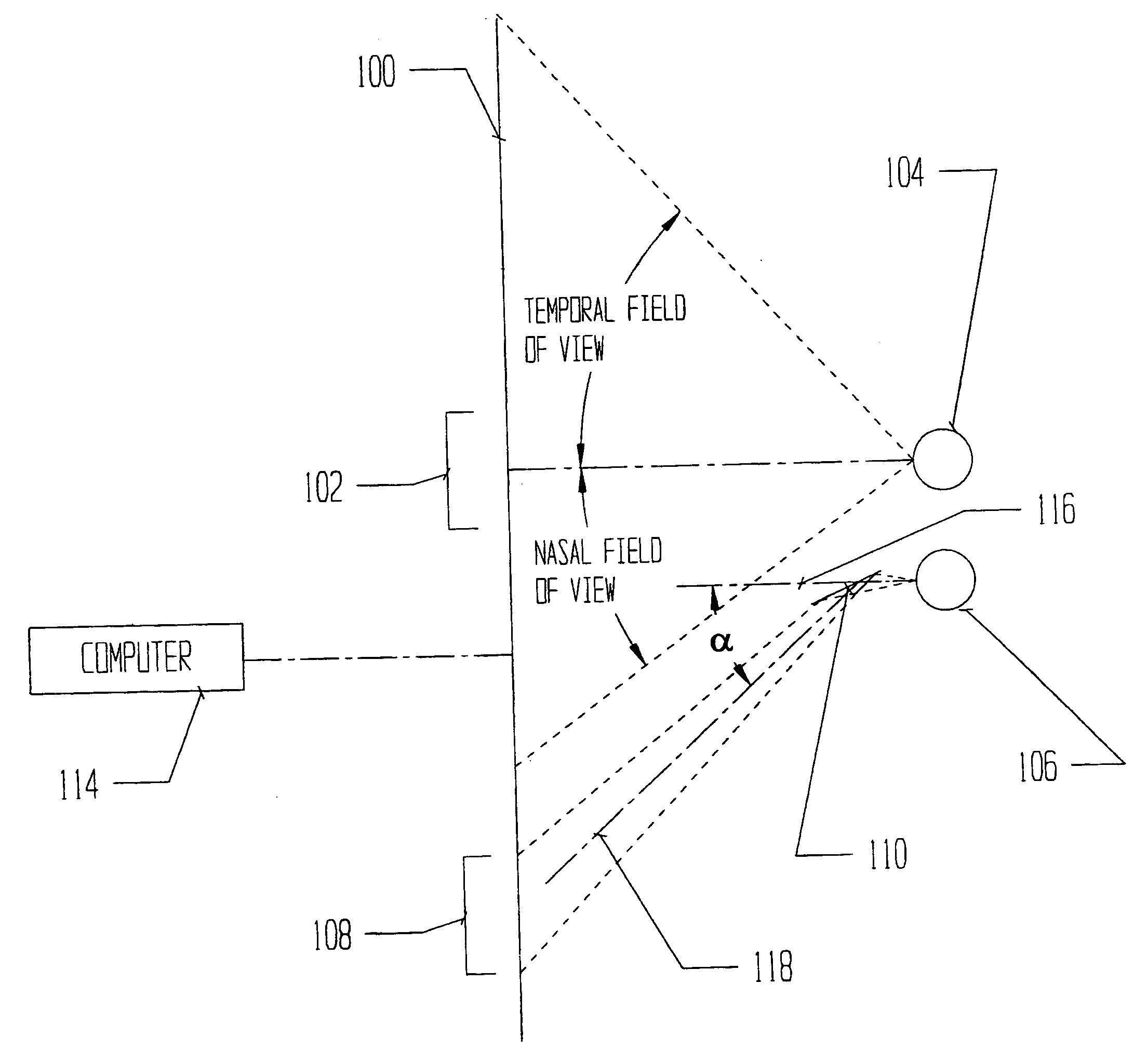 Automated stereocampimeter and related method for improved measurement of the visual field