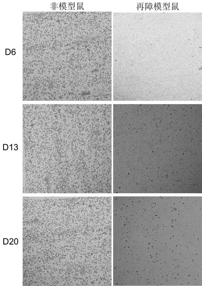 Application of irisin in preparation of medicine for treating aplastic anemia