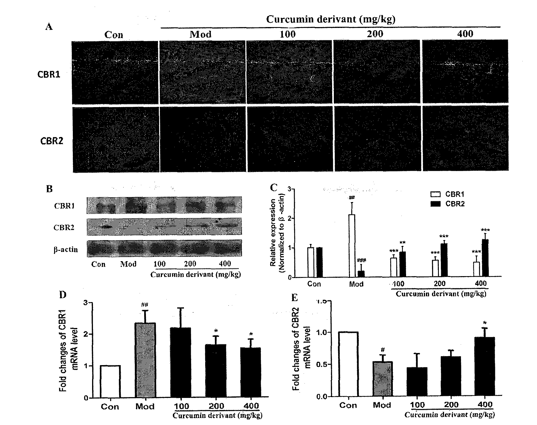 Curcumin derivative and application of curcumin derivative as cannabinoid receptor modulator