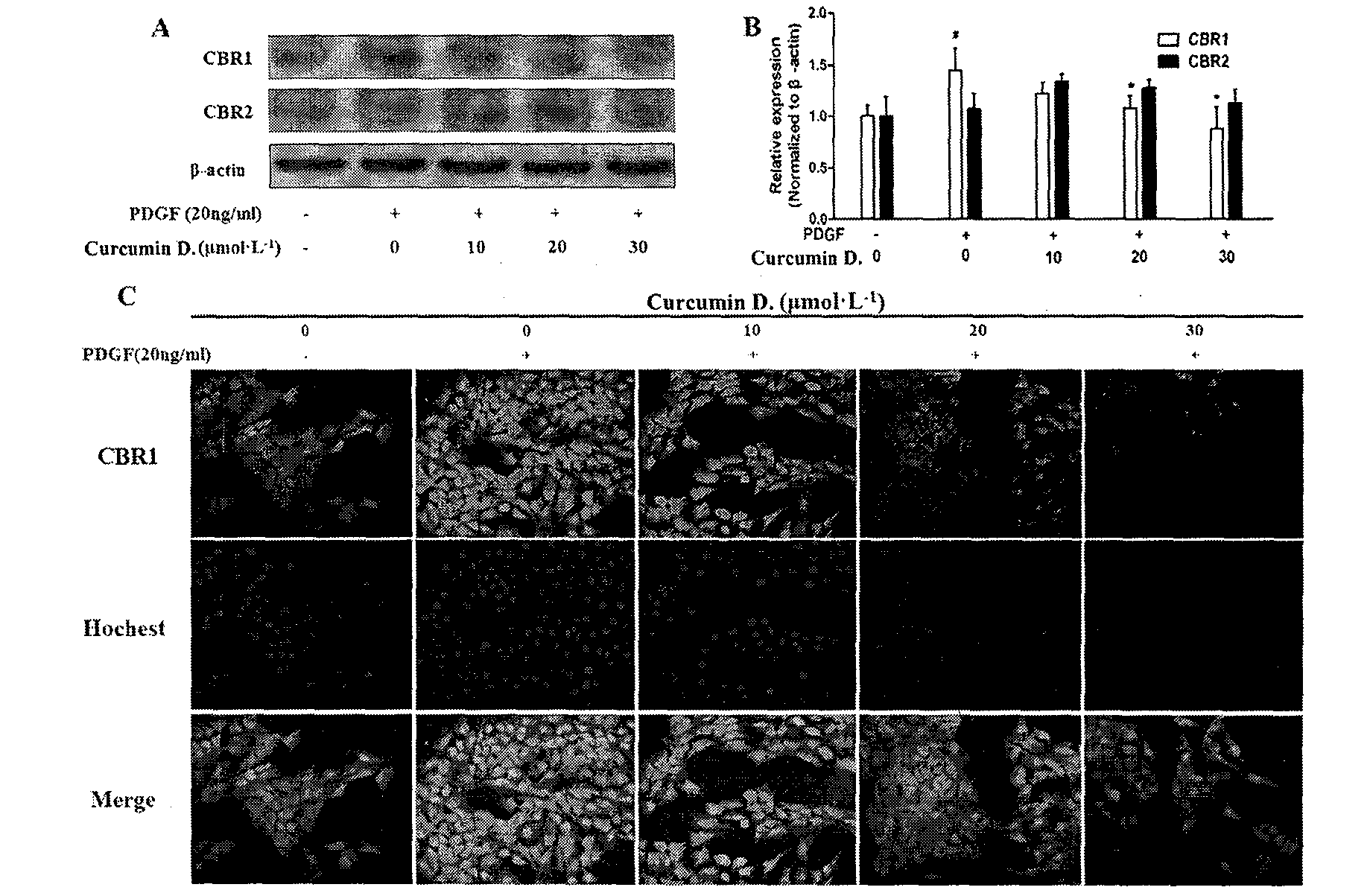 Curcumin derivative and application of curcumin derivative as cannabinoid receptor modulator