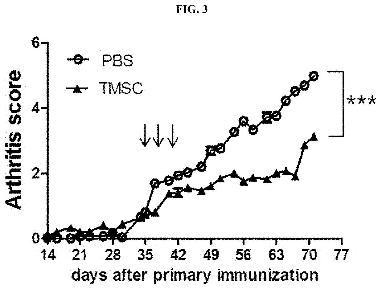 Pharmaceutical composition for preventing or treating rheumatoid arthritis comprising nasal inferior turbinate-derived mesenchymal stem cells as an active ingredient