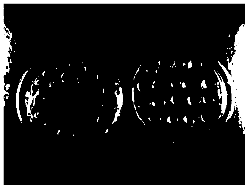 Berberine hydrochloride-matrine-carboxymethyl chitosan composite hydrogel and preparation method and application thereof