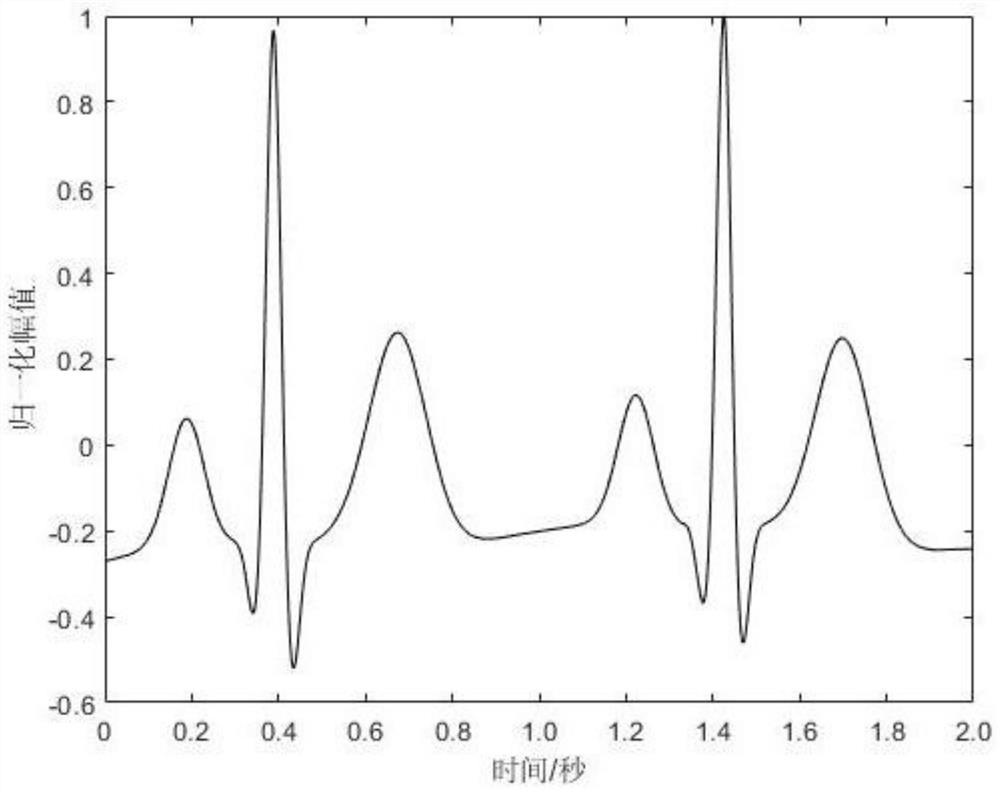 Magnetocardiogram signal denoising method for improving empirical mode decomposition permutation entropy