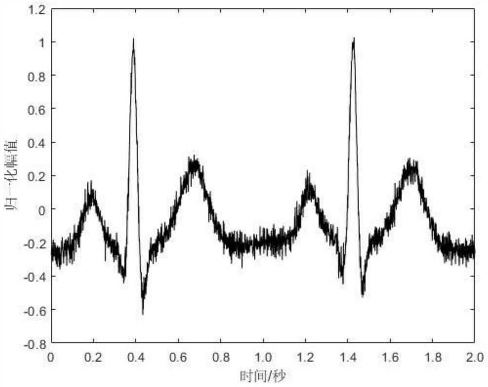 Magnetocardiogram signal denoising method for improving empirical mode decomposition permutation entropy