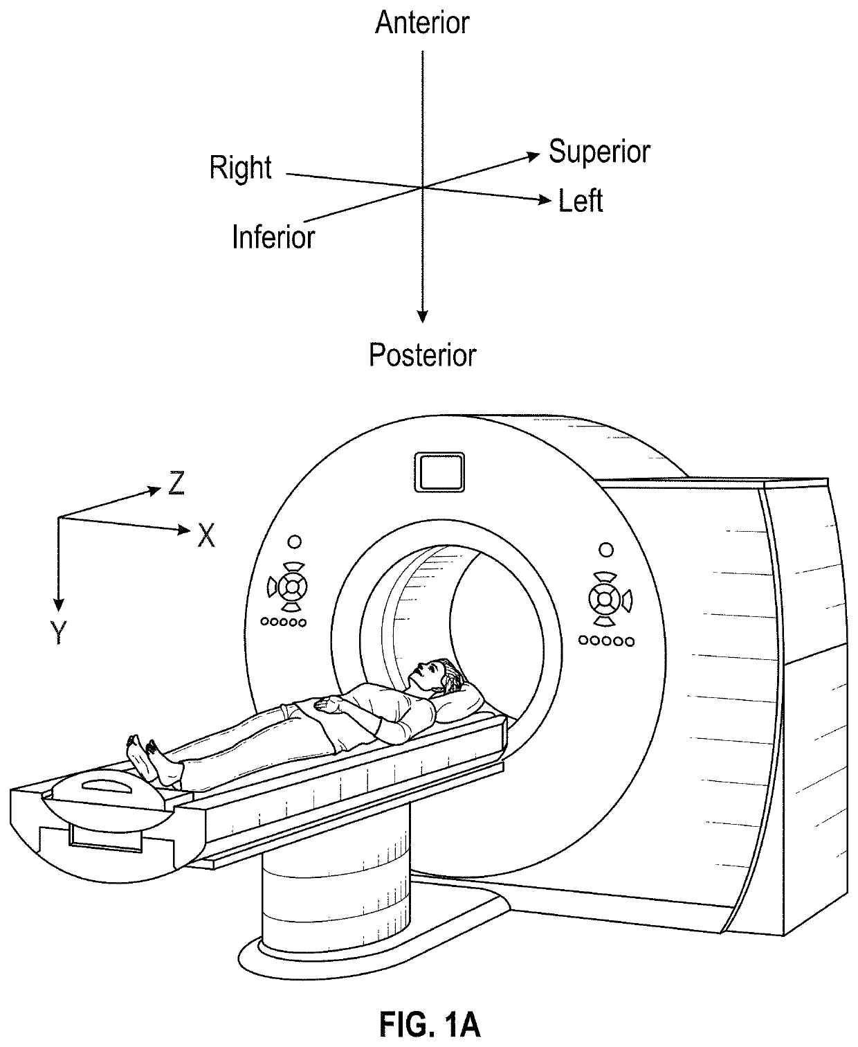 Knee replacement surgical cut planes estimation for restoring pre-arthritic alignment