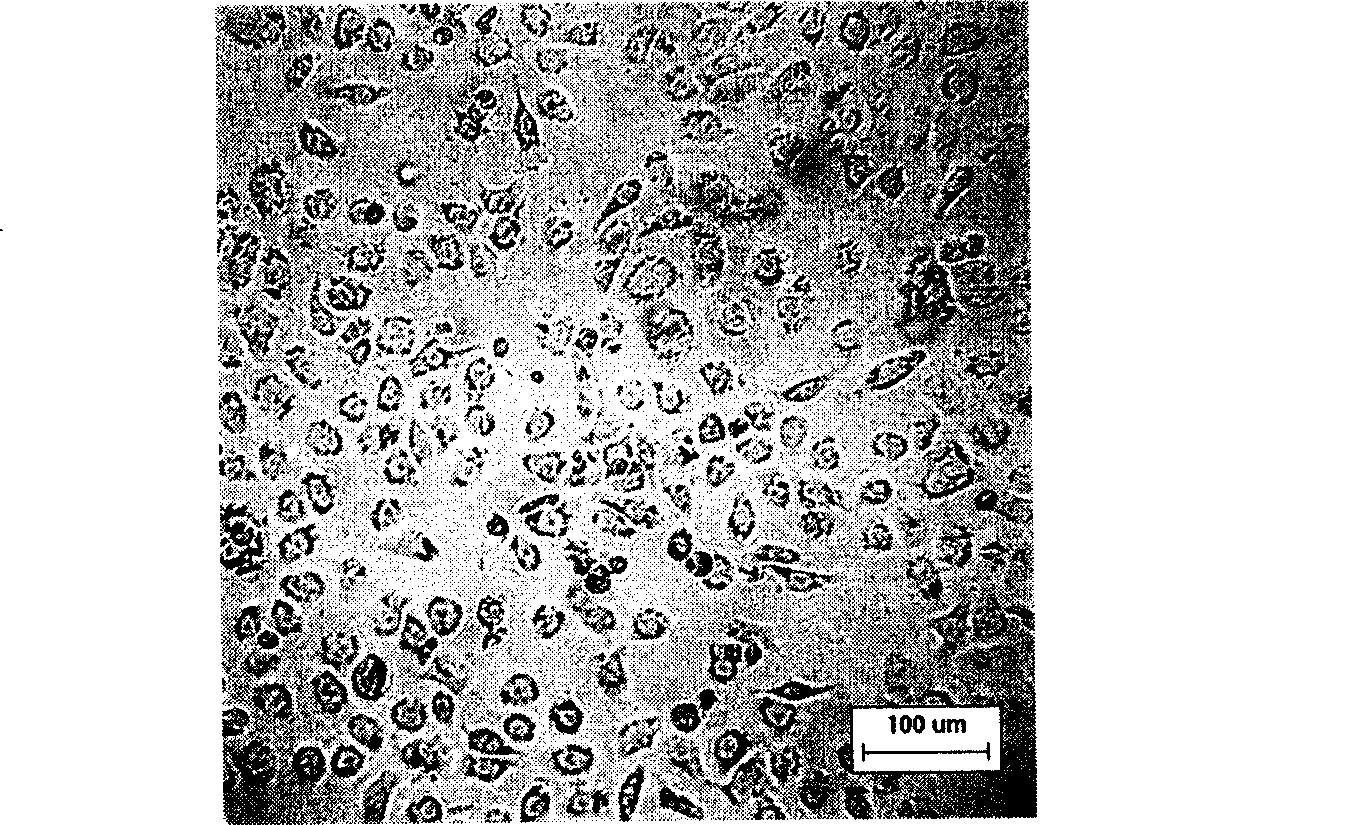 Oophoroma multidrug resistance cell strain established by etoposide induction