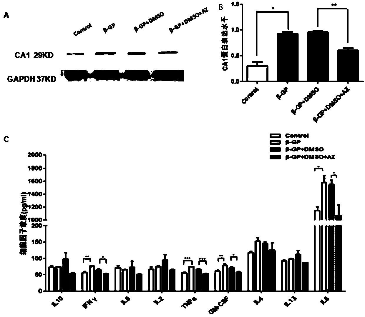 Application of carbonic anhydrase inhibitor to preparation of anti-atherosclerosis drugs