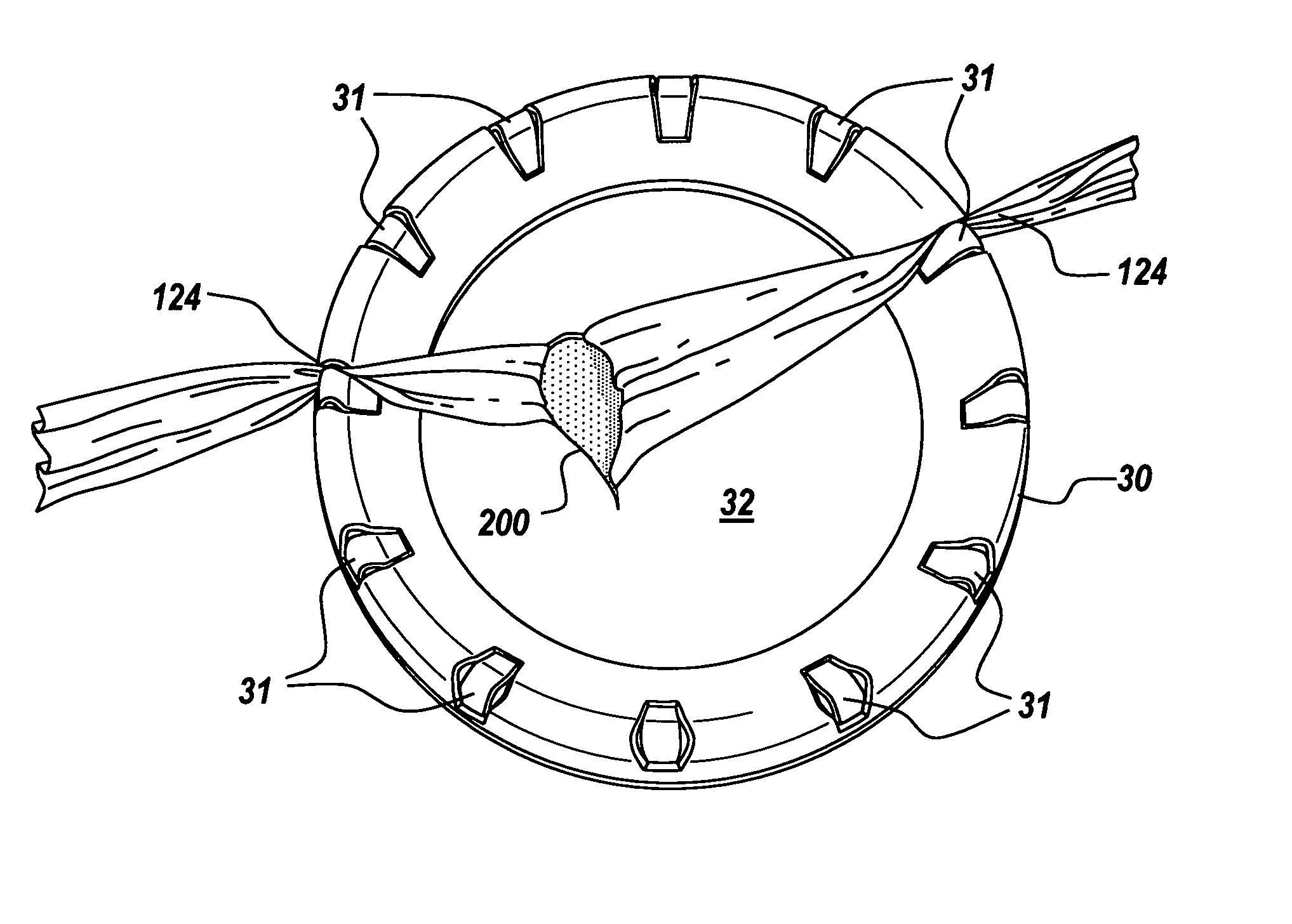 Non-rigid surgical retractor