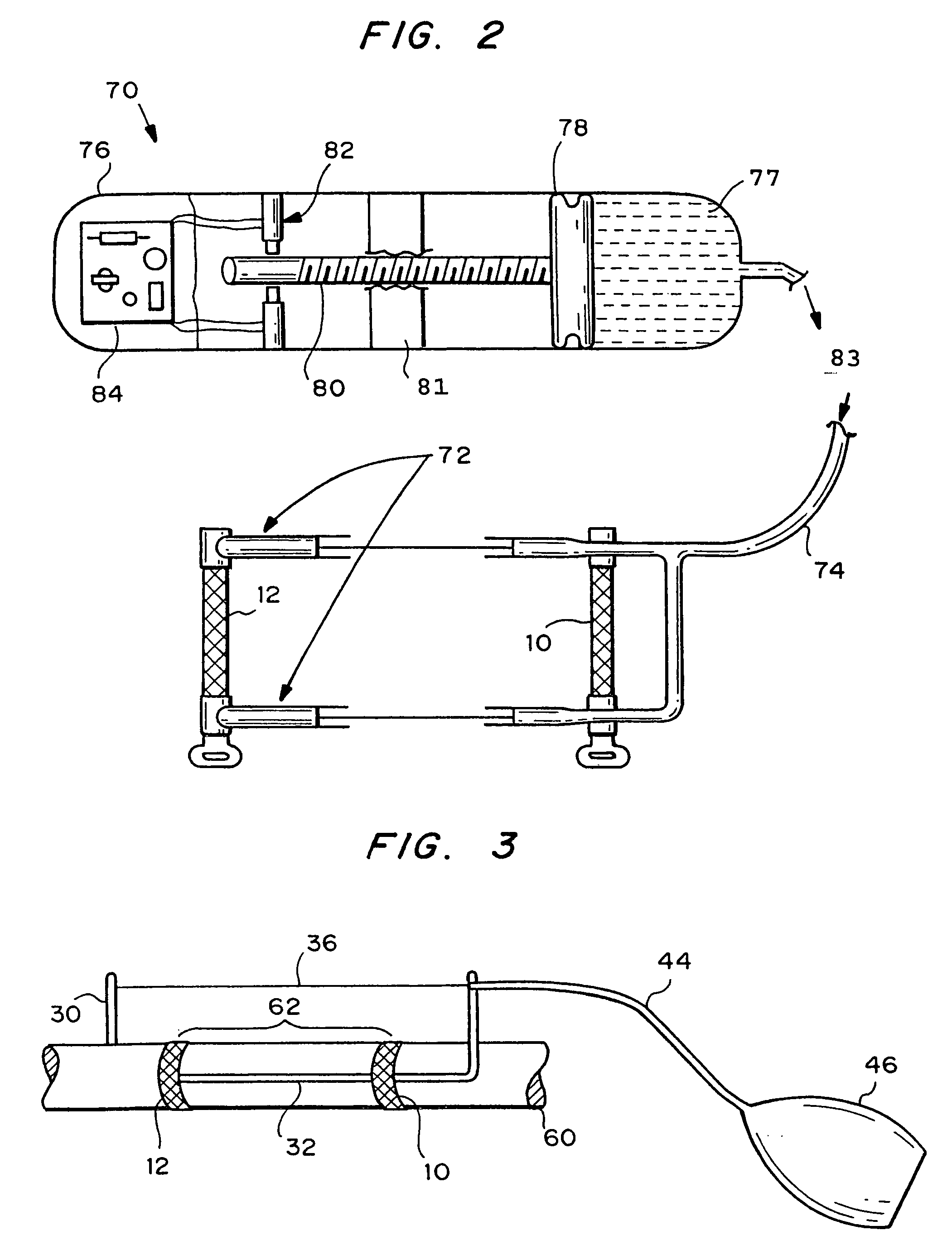 Device and method for creating a vascular graft in vitro