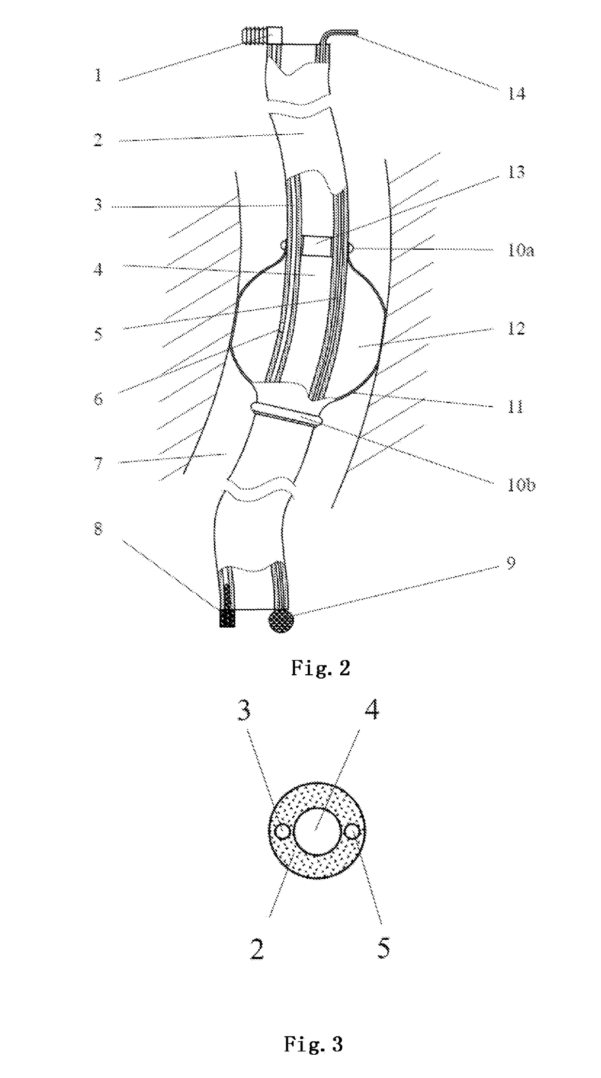 Stomach tube for preventing aspiration