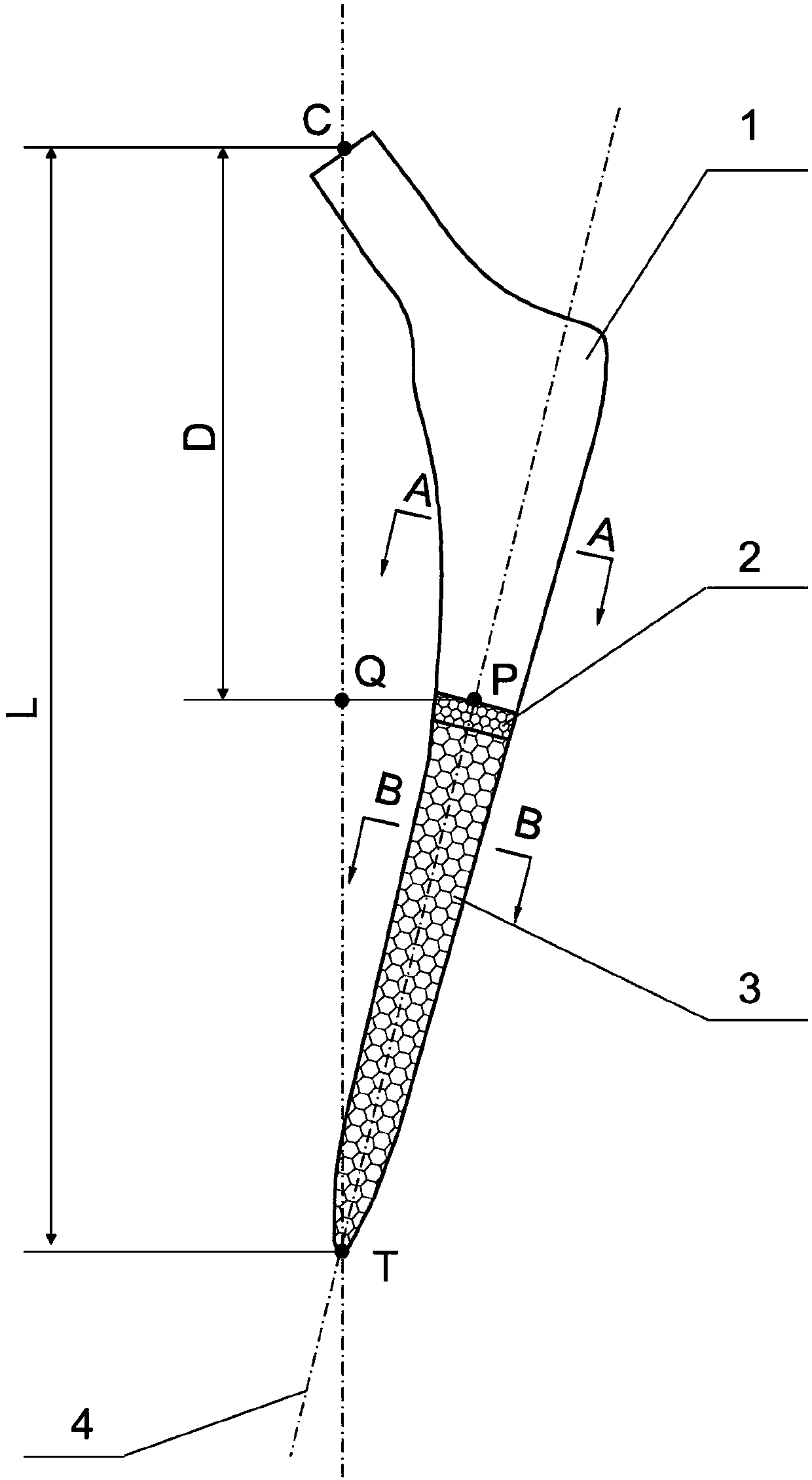 An Adaptive Late Stabilized Femoral Stem Prosthesis