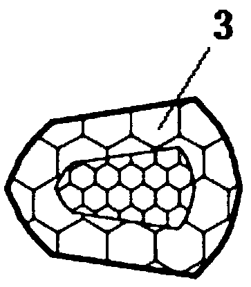 An Adaptive Late Stabilized Femoral Stem Prosthesis