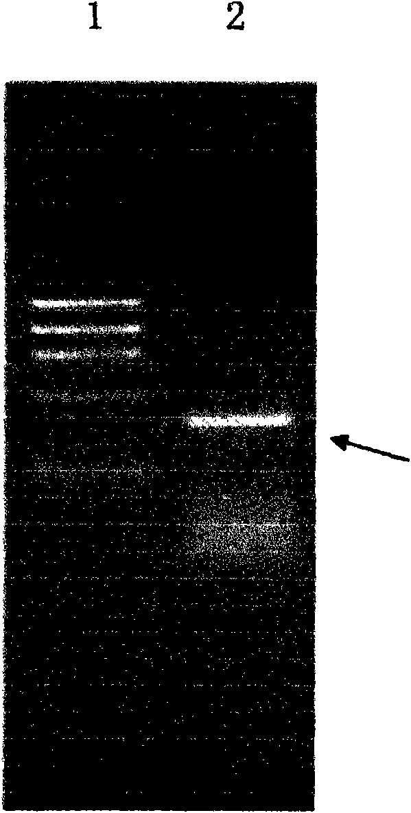 Recombinant virus with coexpression of anthropogenic glutamate decarboxylase and cell factor