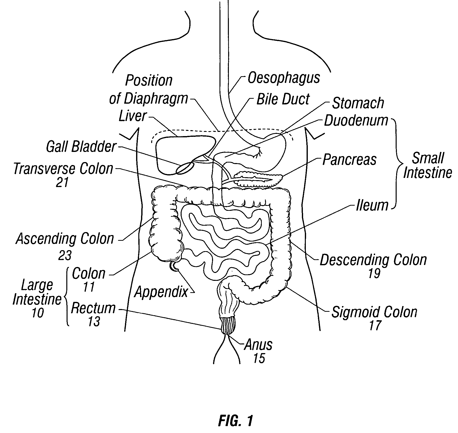 Therapeutic heating and cooling via temperature management of a colon-inserted balloon