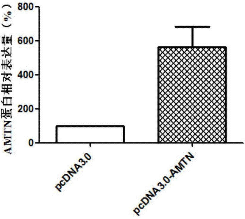 Molecular markerfor diagnosis and treatment of tongue squamous carcinoma