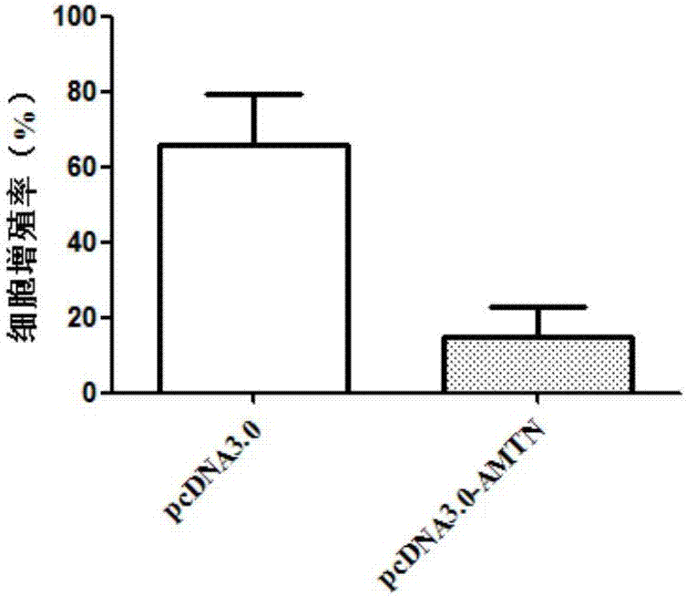 Molecular markerfor diagnosis and treatment of tongue squamous carcinoma