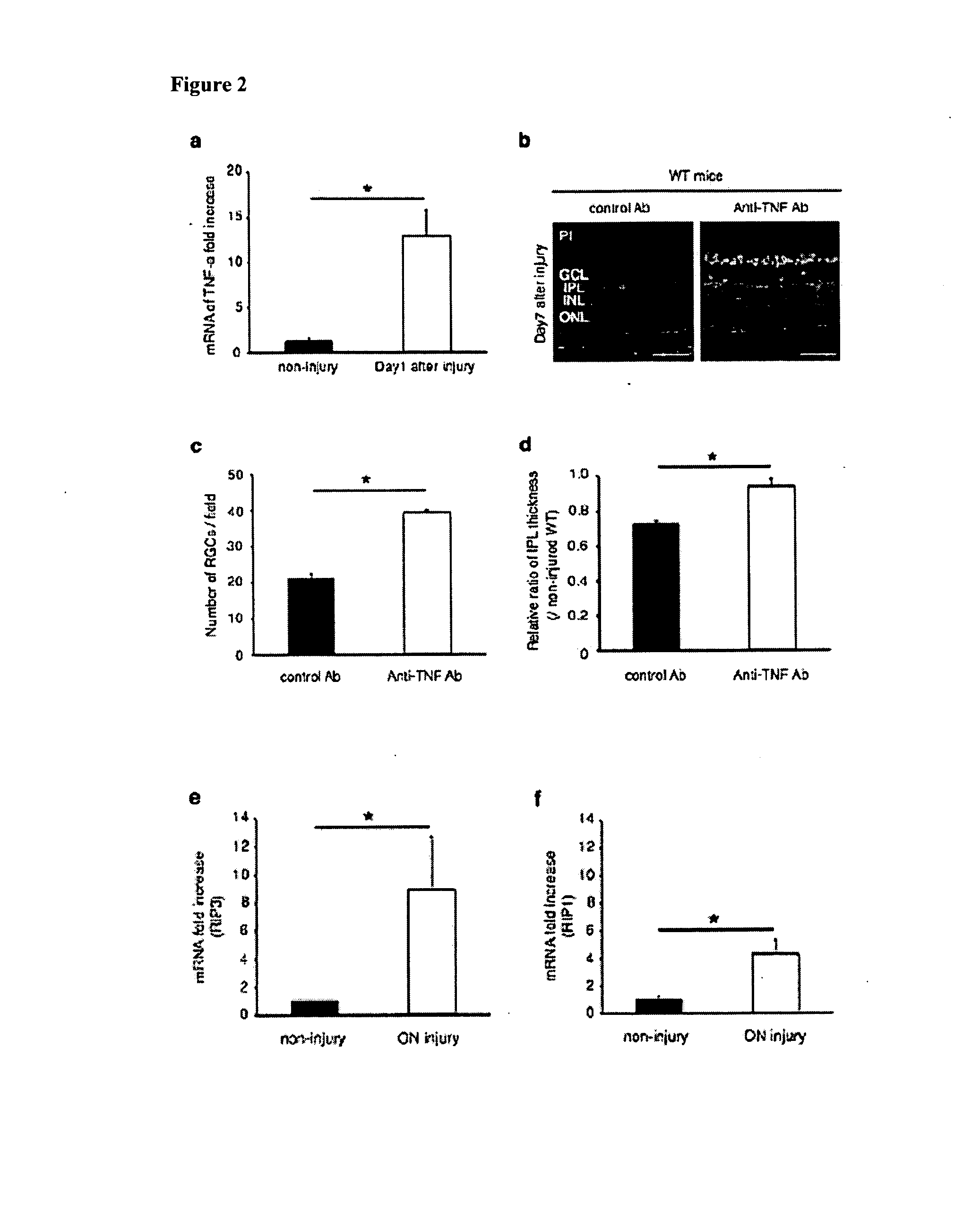 Methods and compositions for preserving retinal ganglion cells