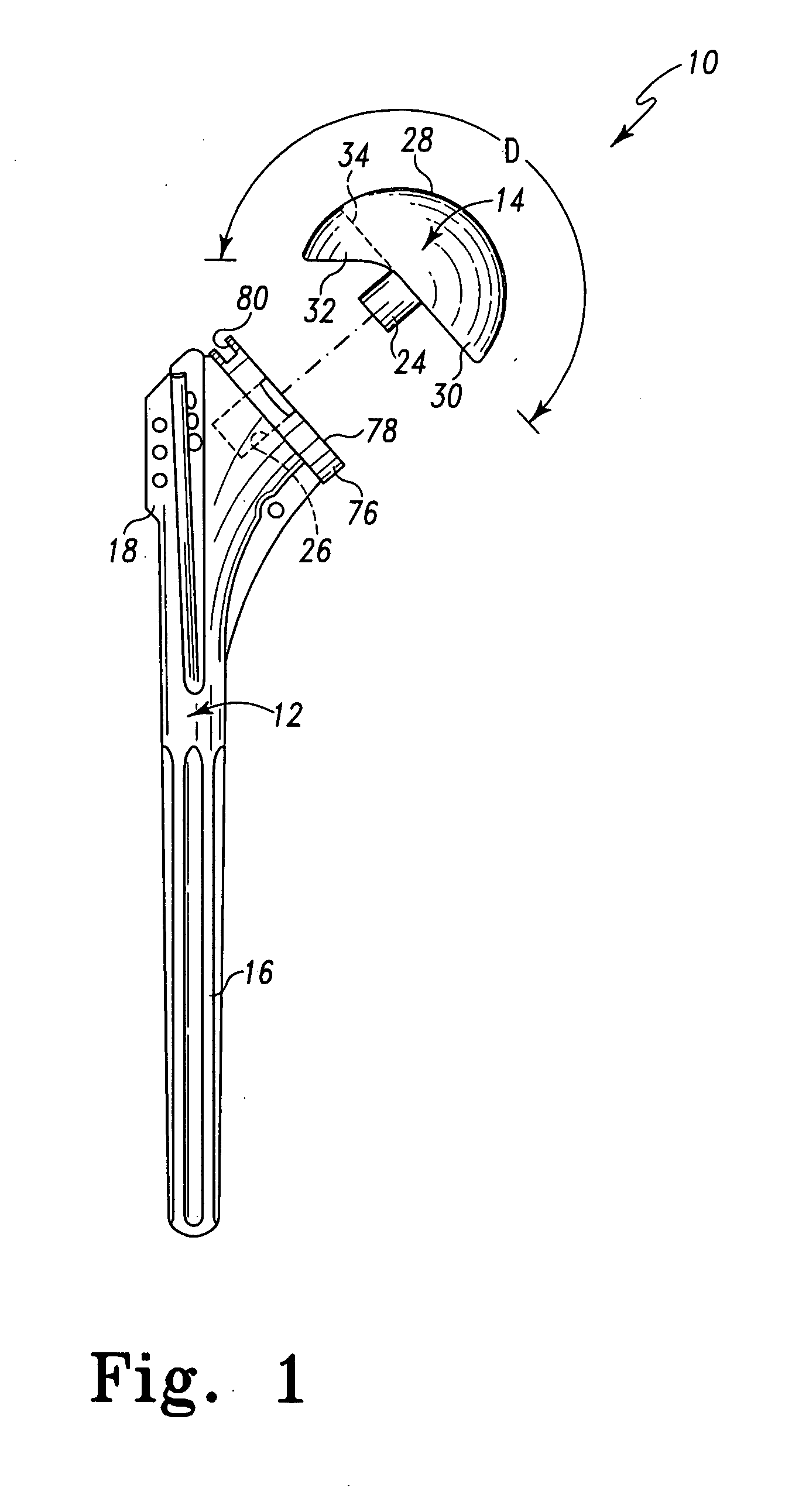 Bone resection apparatus