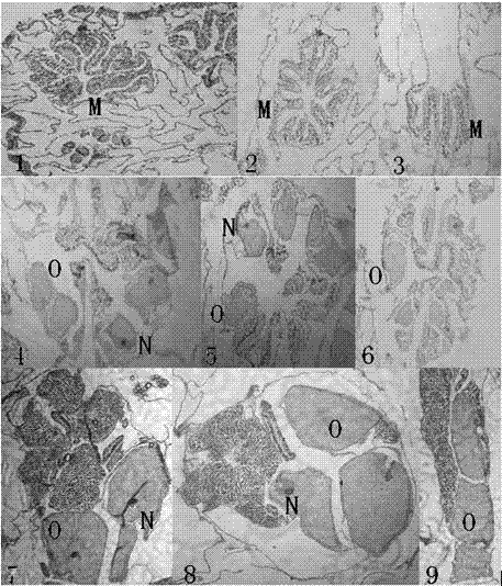 Manufacturing method of paraffin section of hermatypic coral oocyte