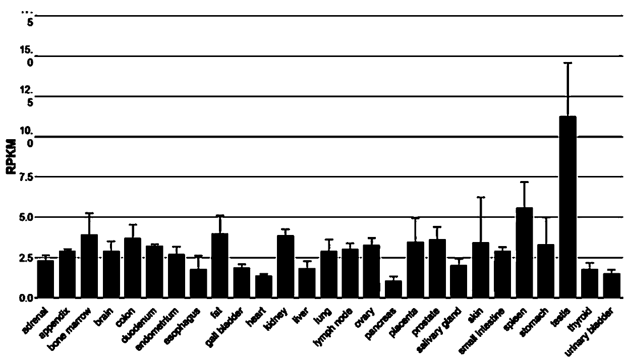 Application of ulcerative colitis biological marker and treatment target spot