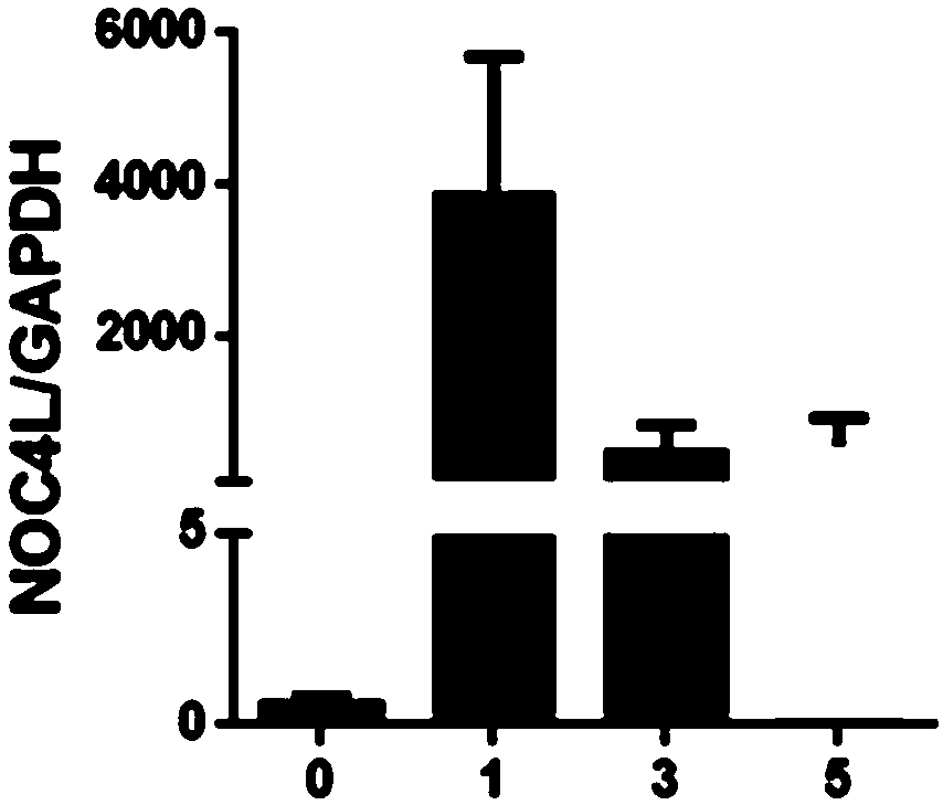 Application of ulcerative colitis biological marker and treatment target spot