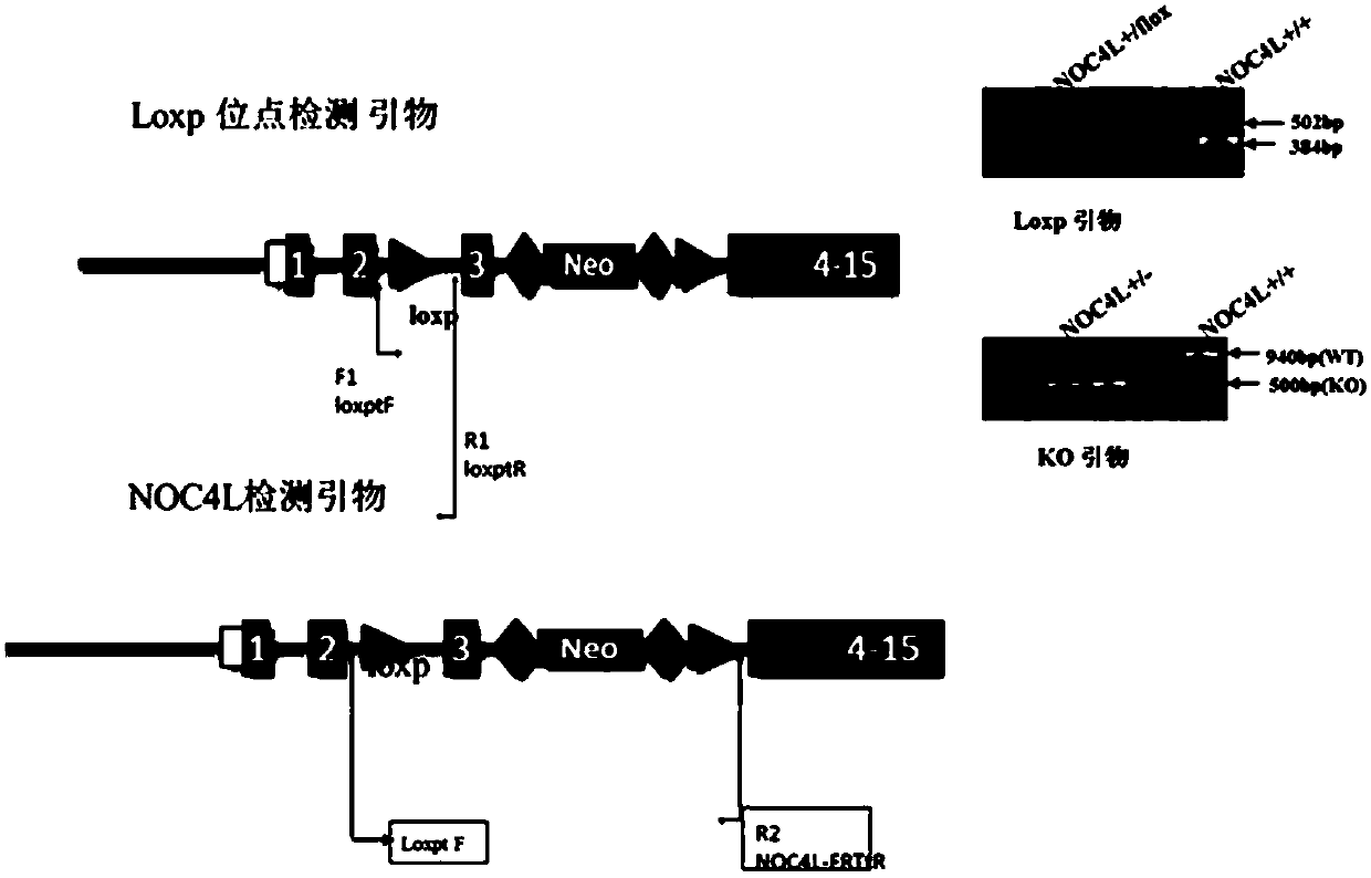 Application of ulcerative colitis biological marker and treatment target spot