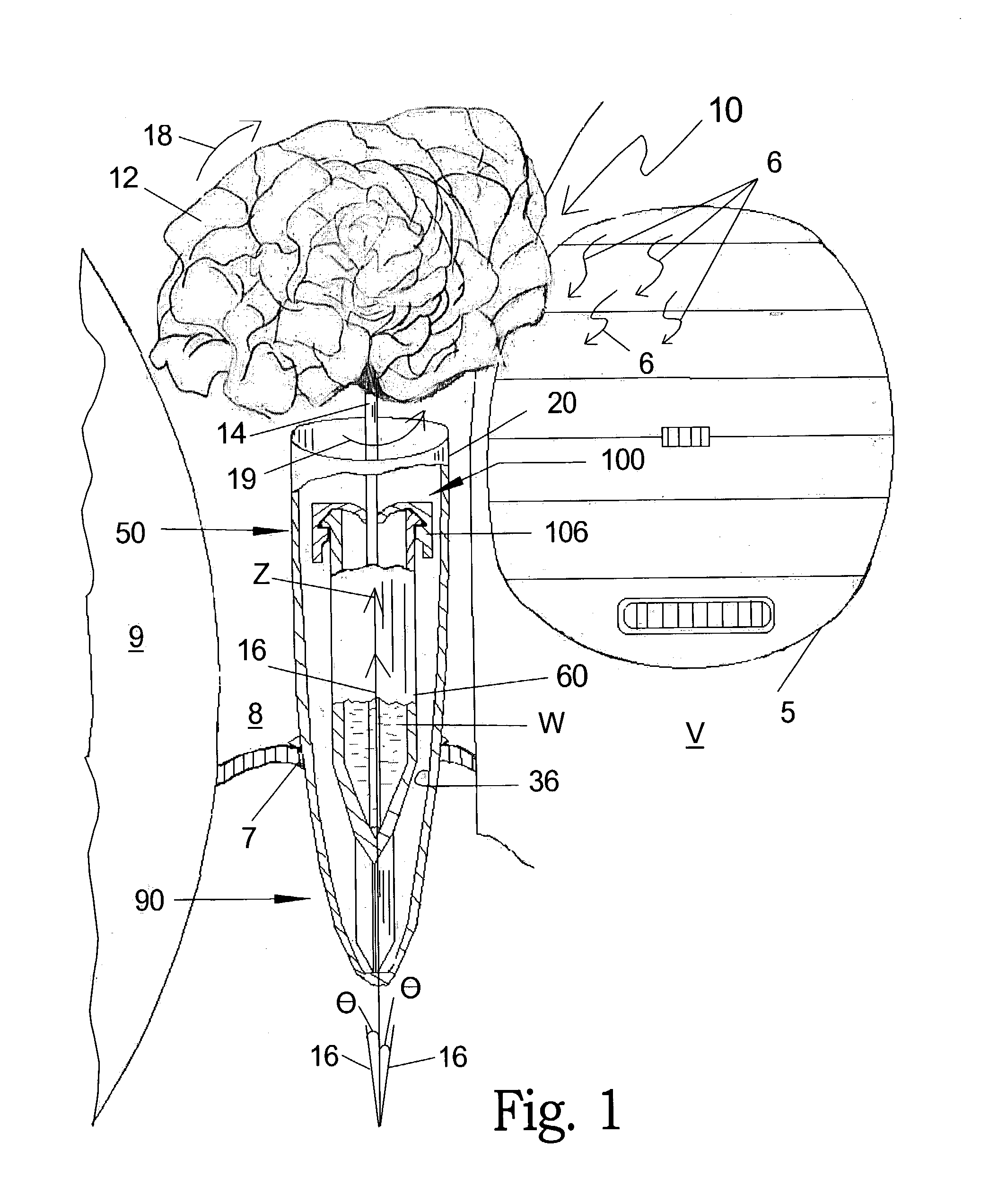 Spinning vase device and method