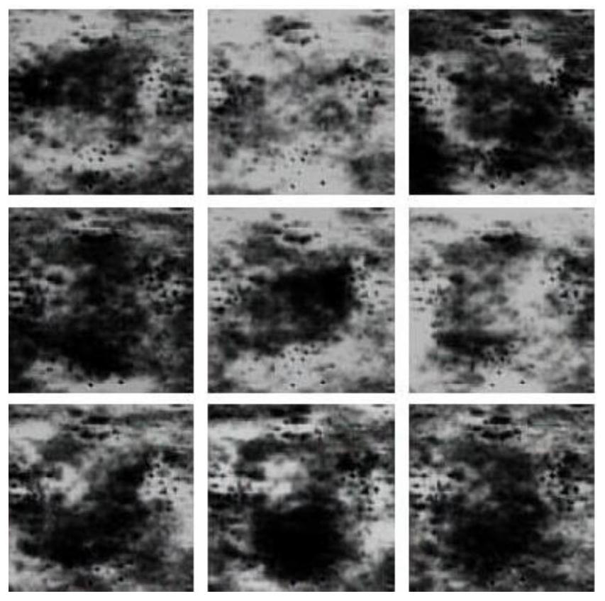 Method for generating medical ultrasonic image data based on adversarial network