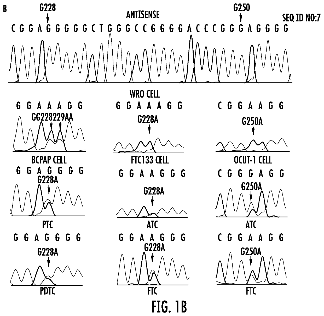 TERT promoter mutations in cancer