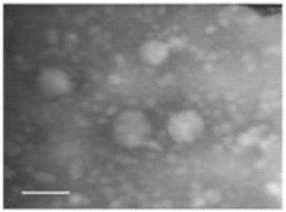 Application of adipose-derived mesenchymal stem cell exosomes in preparation of medicine for treating metabolic syndrome