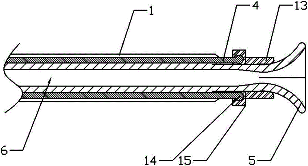 Easy angle adjustment puncture device for ovarian tumors