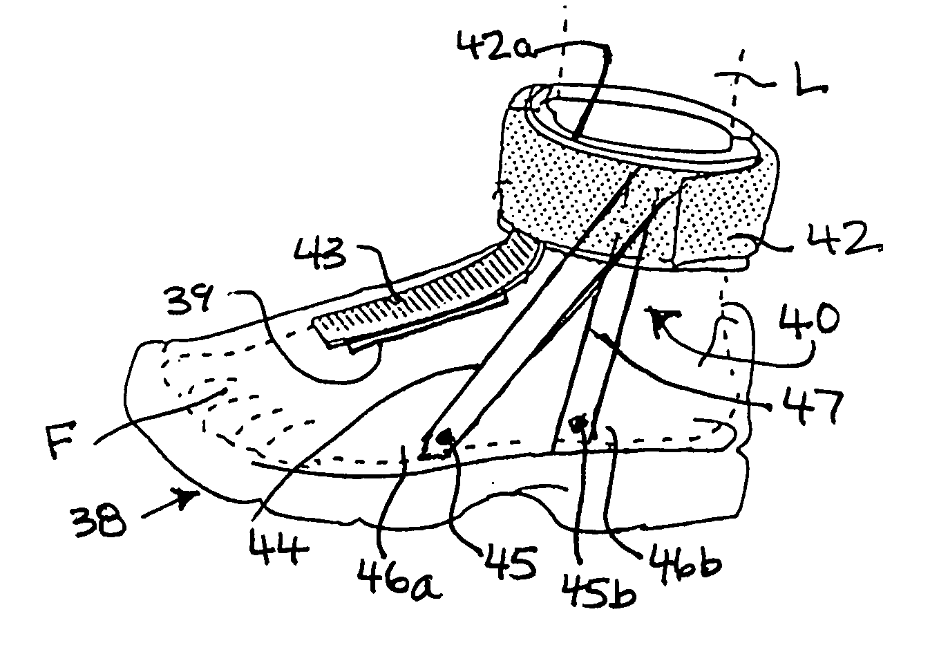 Foot eversion inhibitor