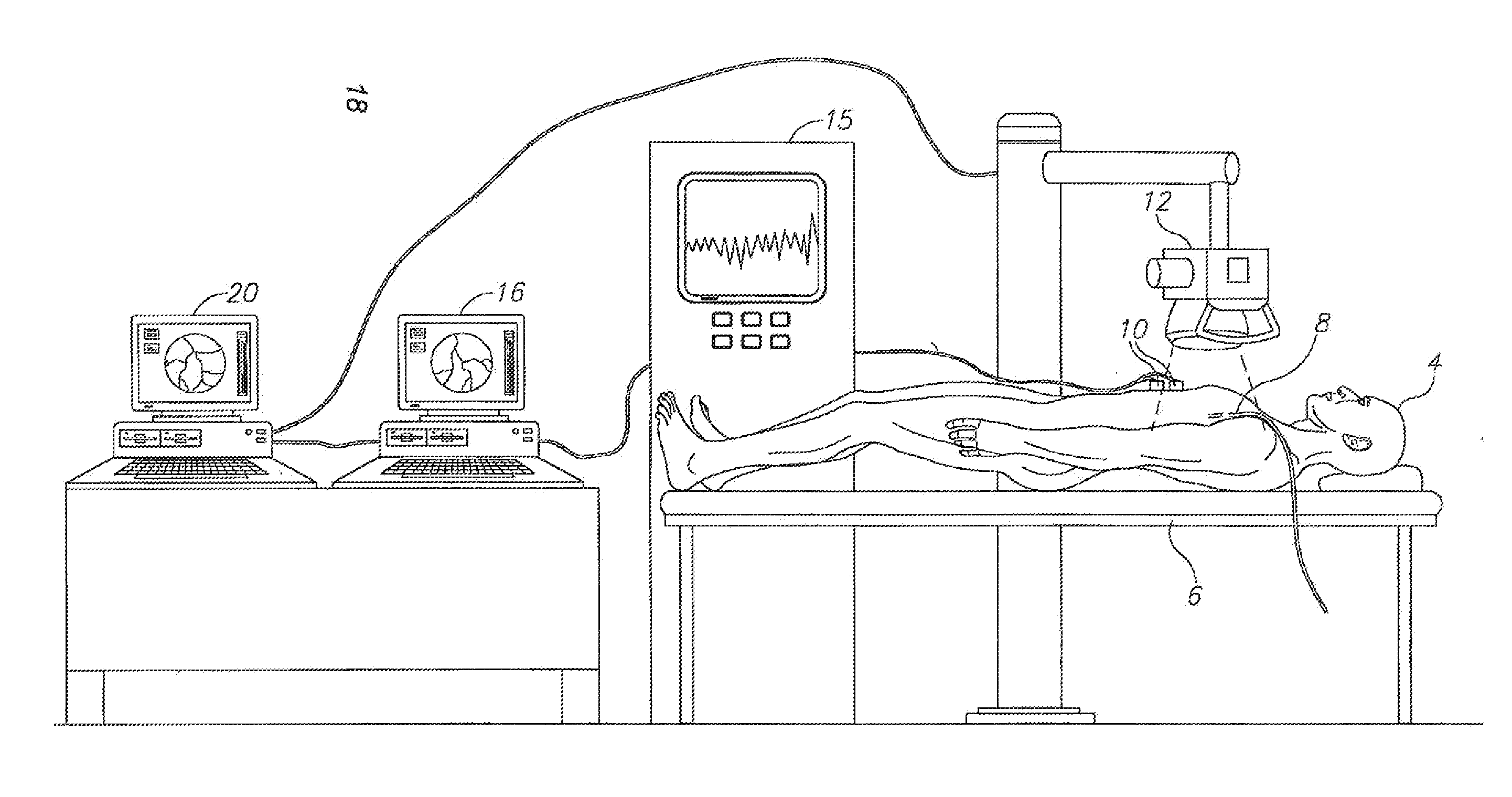 Method and system for detecting and analyzing heart mecahnics