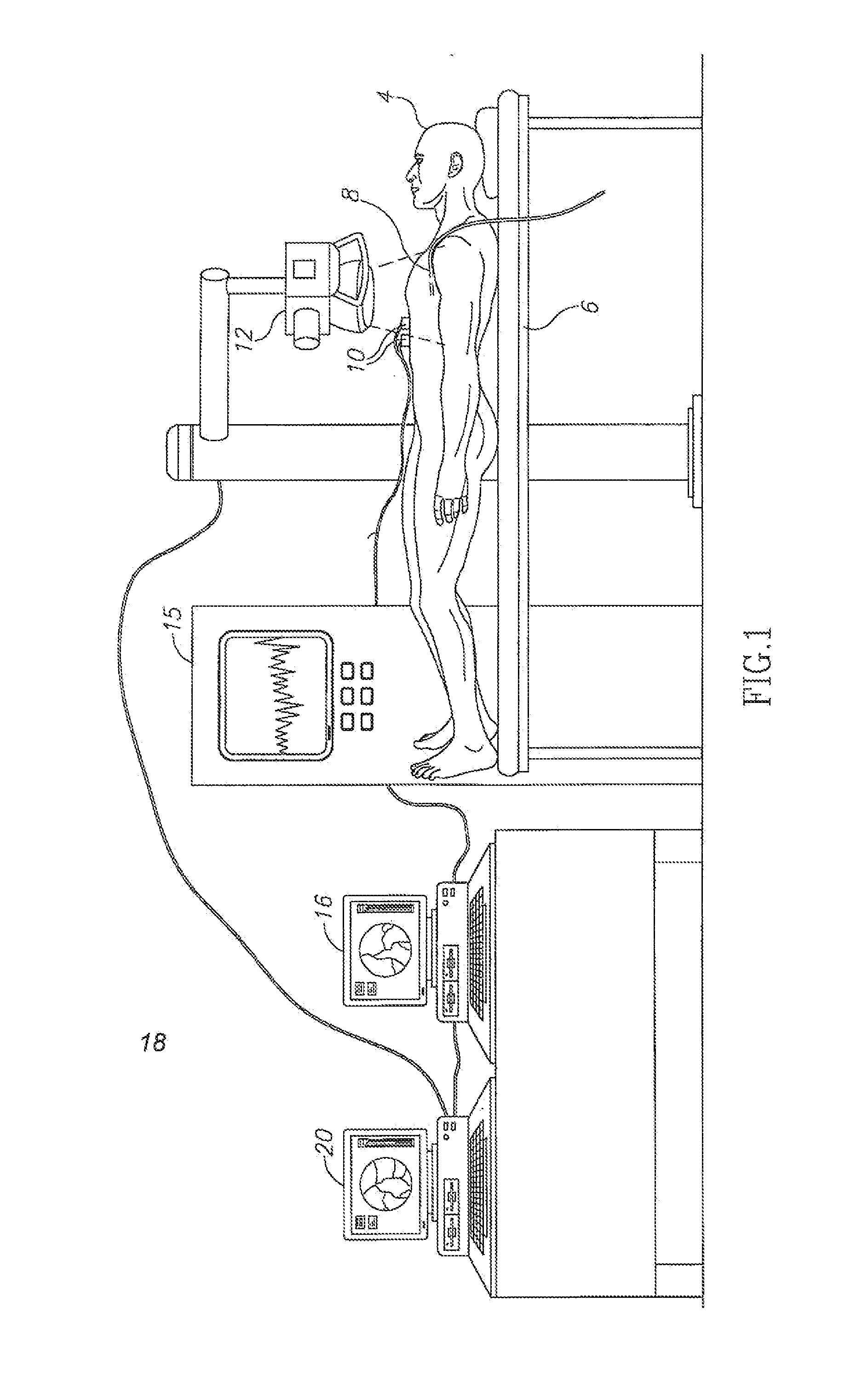 Method and system for detecting and analyzing heart mecahnics