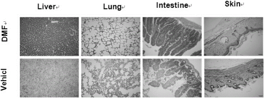 Application of dimethyl fumarate to preparation of medicine for preventing and treating graft versus host diseases and graft versus leukemia