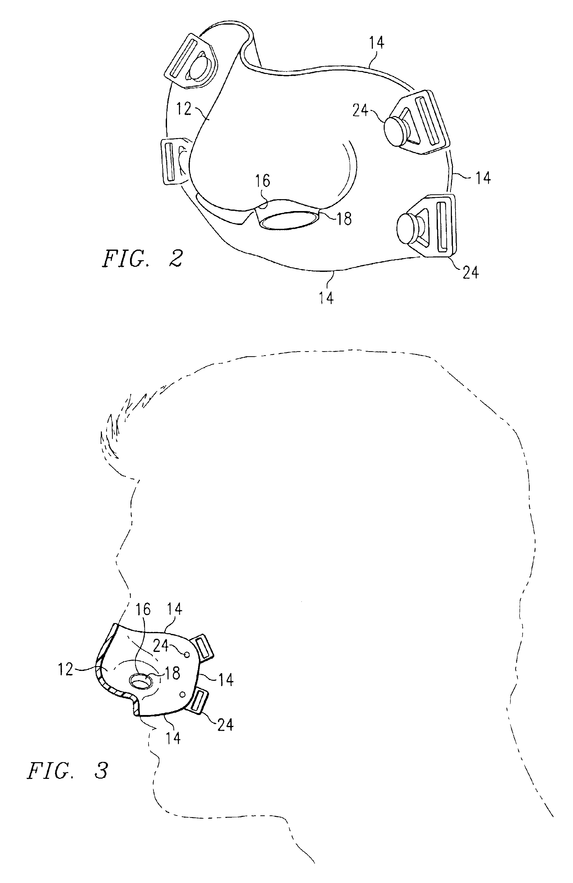 Custom fitted mask and method of forming same