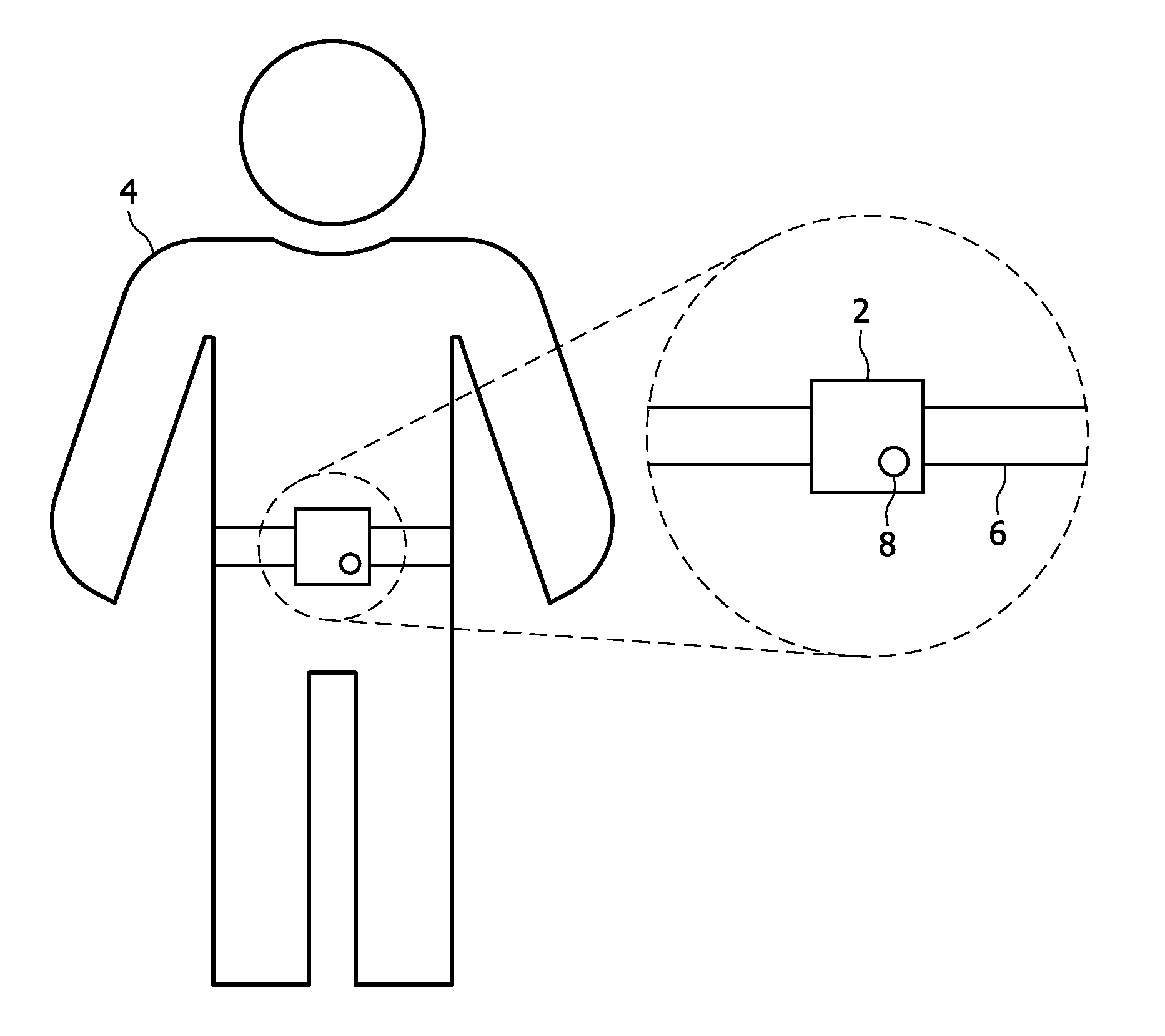 Fall detection and/or prevention systems