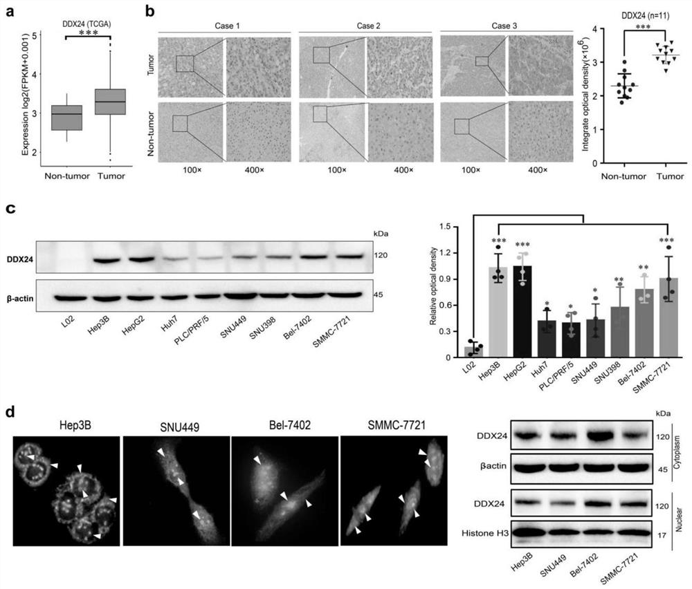 Application of DDX24 and upstream and downstream molecules RFX8 and Lamb1 thereof in diagnosis and treatment of hepatocellular carcinoma