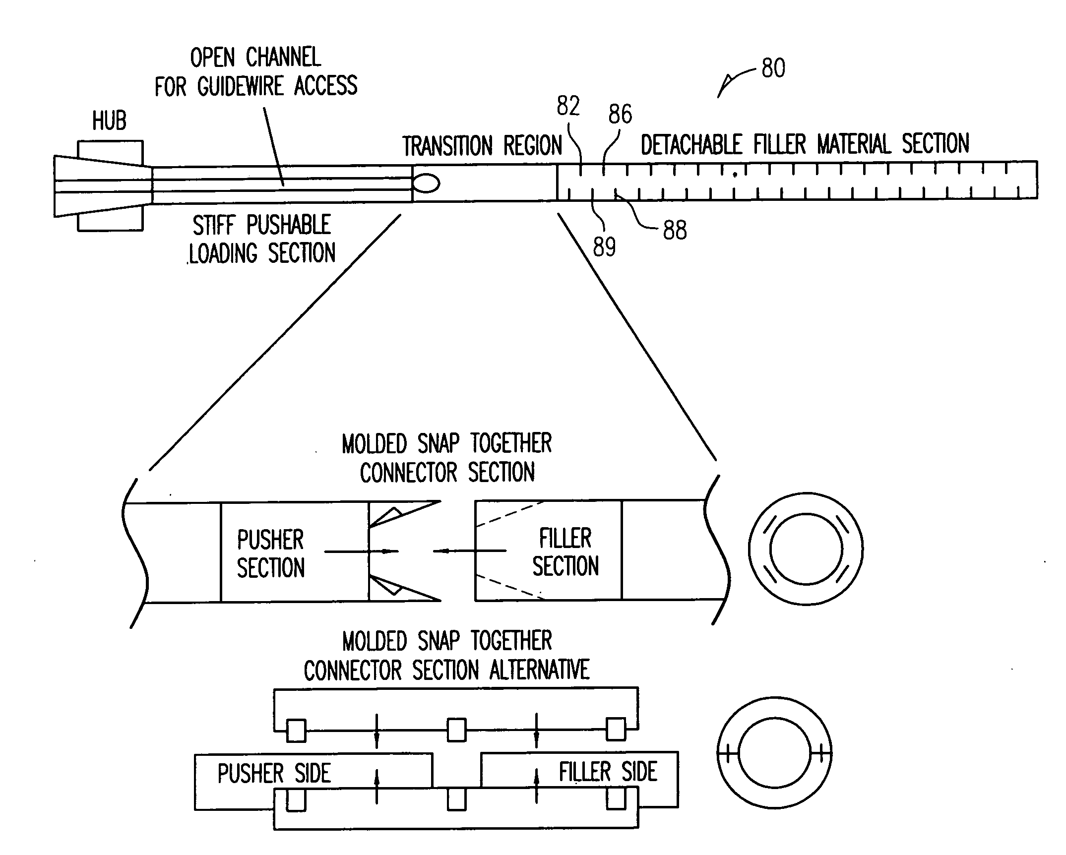 Multiple point detacher system