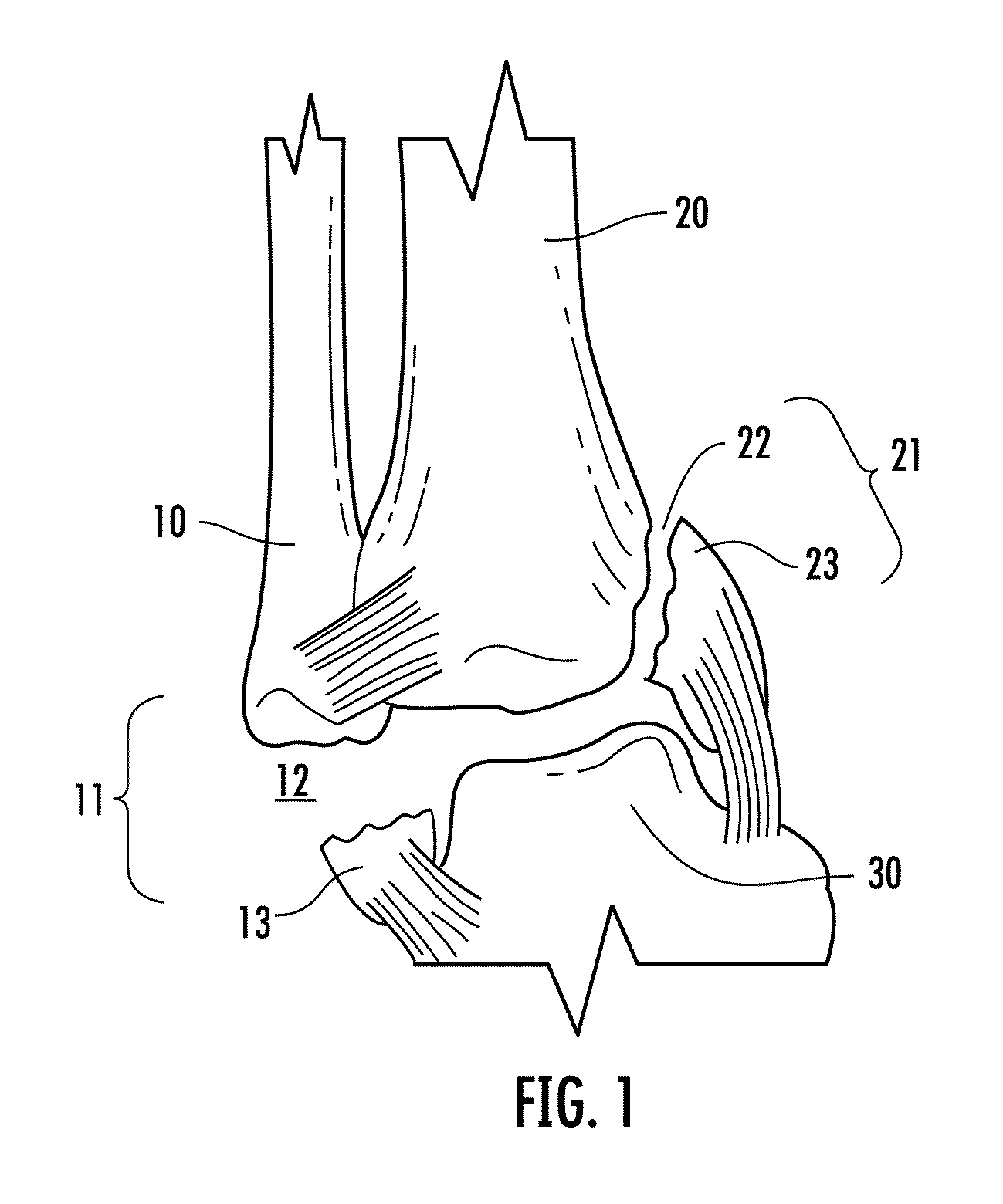 Holder/impactor for contoured bone plate for fracture fixation