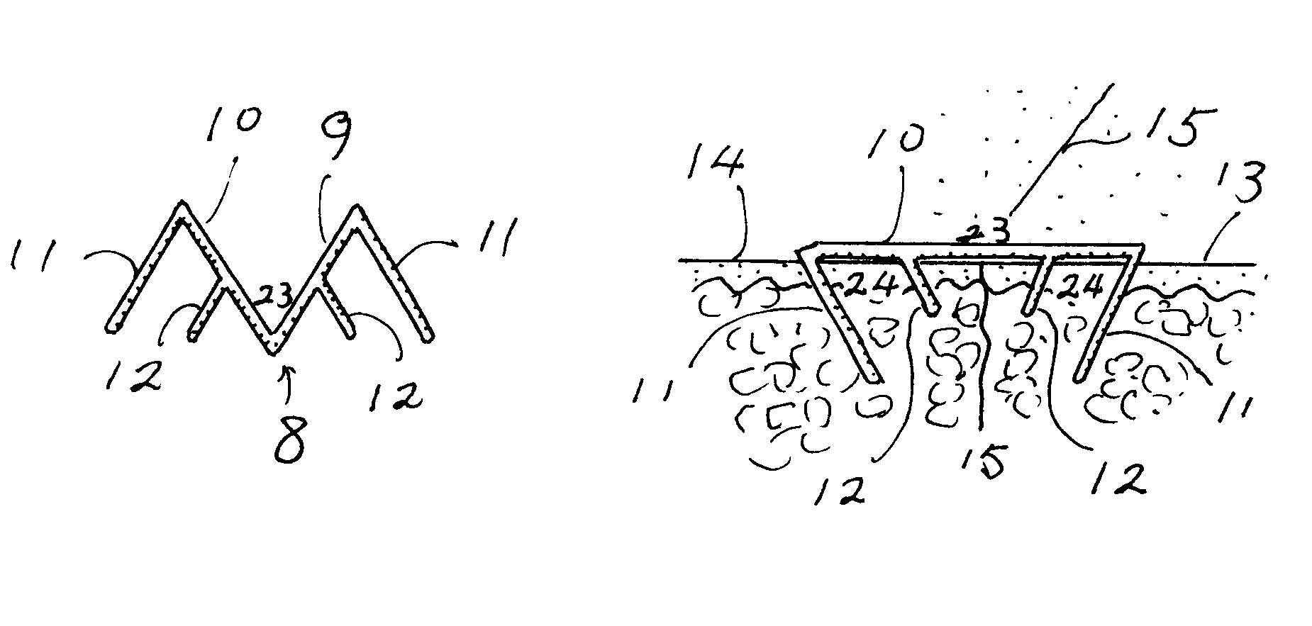 Four-spikes surgical skin staple