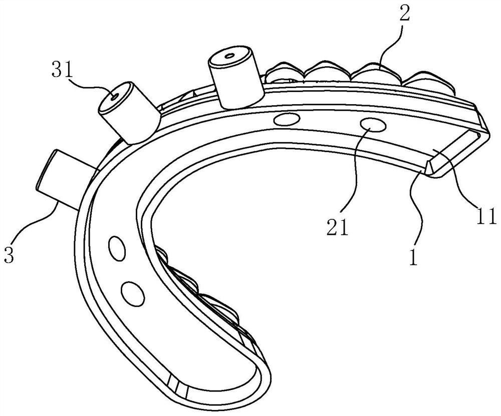 Instant load-bearing transition denture, combined device and digital preparation method