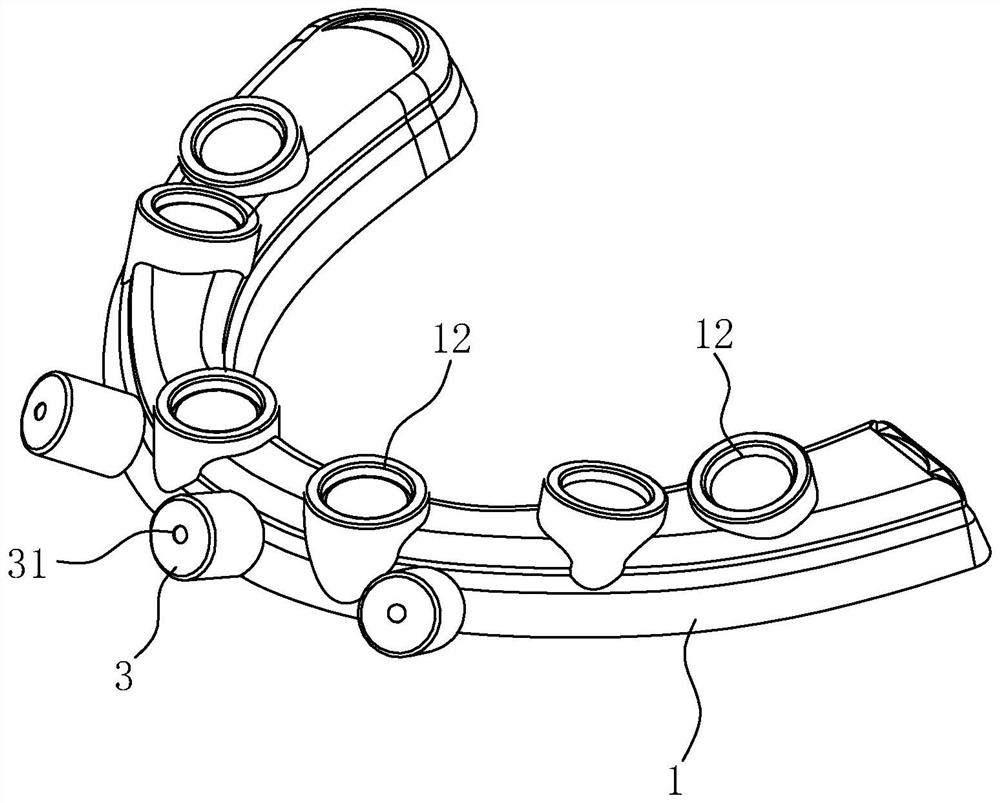 Instant load-bearing transition denture, combined device and digital preparation method