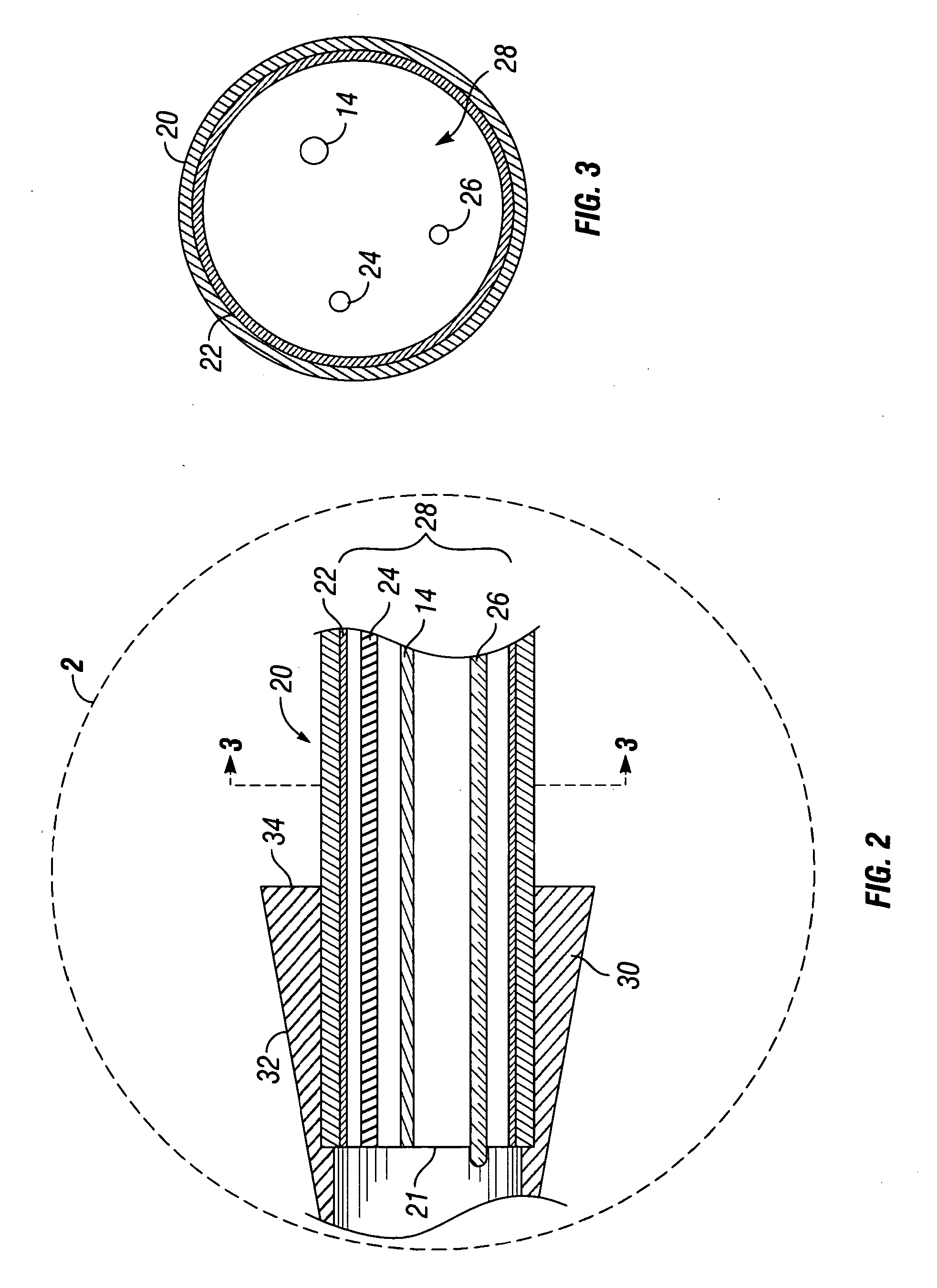 Esophageal dilation and stent delivery system and method of use